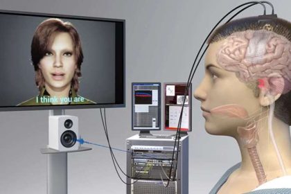 Felçli insan yapay zeka implantı ile konuştu!