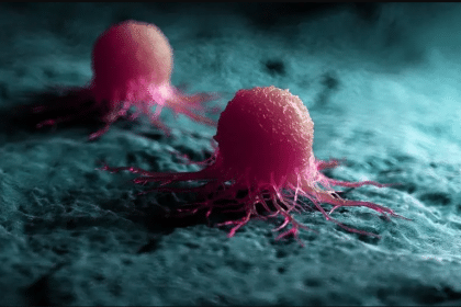 İngiliz bilim insanlarının çalışması, yapay zekanın nadir sarkom kanserini daha iyi teşhis ettiğini gösteriyor.