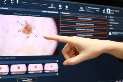 Yapay zekâ, lezyonları değerlendirerek melanom gibi cilt kanserlerini erken evrelerde saptama potansiyeli sunuyor.